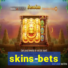 skins-bets