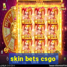 skin bets csgo